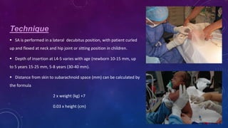 Technique
 SA is performed in a lateral decubitus position, with patient curled
up and flexed at neck and hip joint or sitting position in children.
 Depth of insertion at L4-5 varies with age (newborn 10-15 mm, up

to 5 years 15-25 mm, 5-8 years (30-40 mm).
 Distance from skin to subarachnoid space (mm) can be calculated by
the formula

2 x weight (kg) +7
0.03 x height (cm)

 