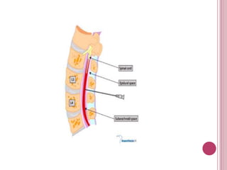 Spinal anesthesia slides | PPTX