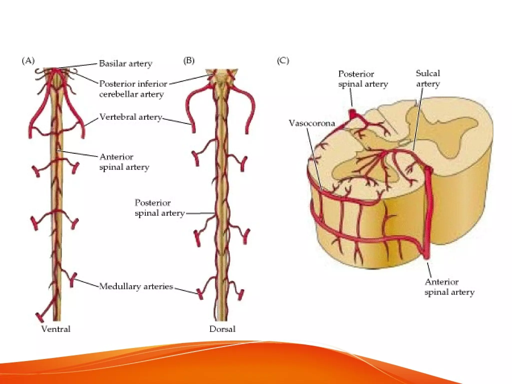 Spinal arteriovenous malformations | PPT