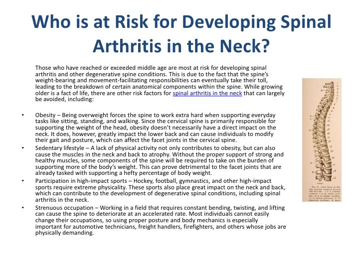 Natural Treatment For Neck Arthritis Natural Treatment For Neck Arthritis