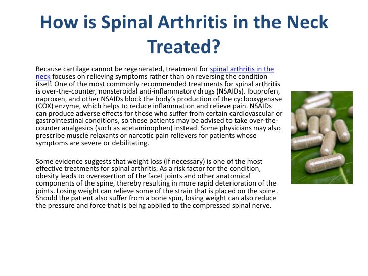 Spinal Arthritis Neck