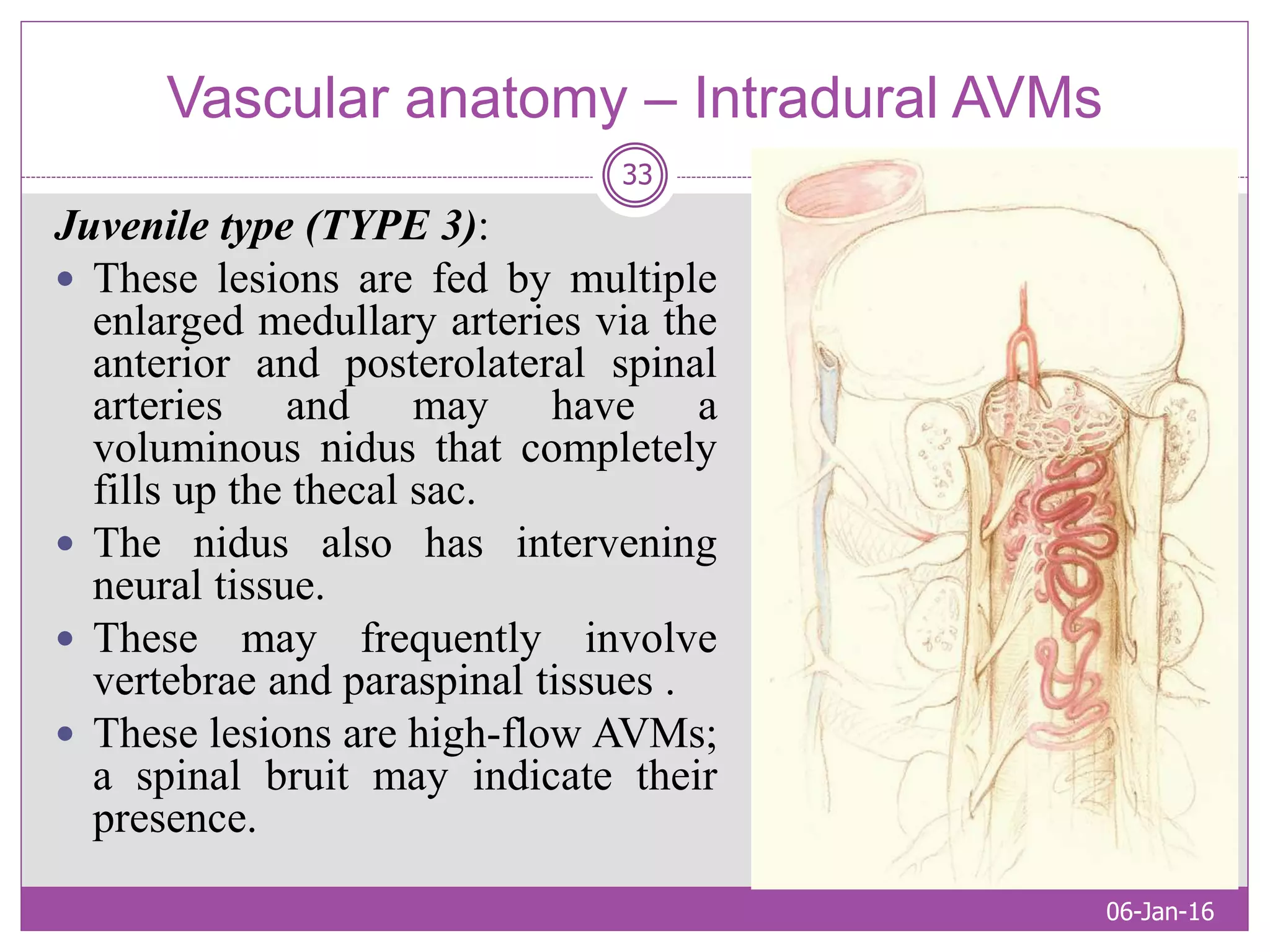 SPINAL CORD ARTERIOVENOUS MALFORMATIONS | PPTX