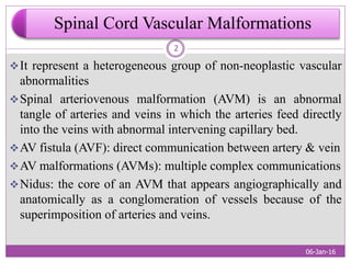 SPINAL CORD ARTERIOVENOUS MALFORMATIONS | PPTX