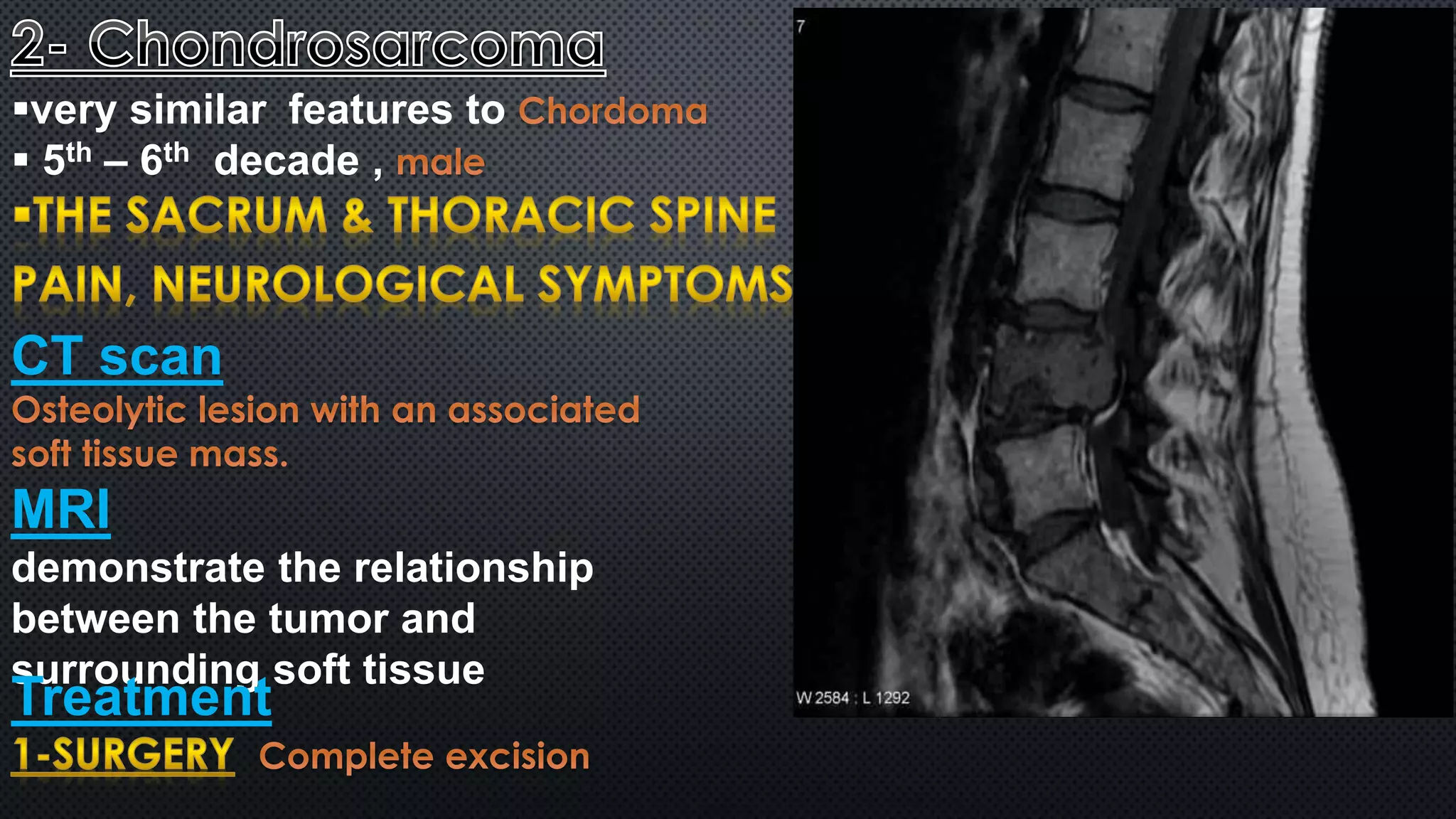very similar features to 
 5th – 6th decade , 
CT scan 
MRI 
demonstrate the relationship 
between the tumor and 
surrounding soft tissue 
Treatment 
 