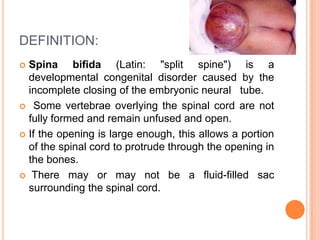 DEFINITION:
 Spina bifida (Latin: "split spine") is a
developmental congenital disorder caused by the
incomplete closing of the embryonic neural tube.
 Some vertebrae overlying the spinal cord are not
fully formed and remain unfused and open.
 If the opening is large enough, this allows a portion
of the spinal cord to protrude through the opening in
the bones.
 There may or may not be a fluid-filled sac
surrounding the spinal cord.
 