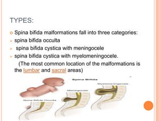 TYPES:
 Spina bifida malformations fall into three categories:
 spina bifida occulta
 spina bifida cystica with meningocele
 spina bifida cystica with myelomeningocele.
(The most common location of the malformations is
the lumbar and sacral areas)
 
