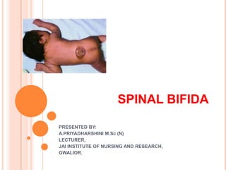 SPINAL BIFIDA

PRESENTED BY:
A.PRIYADHARSHINI M.Sc (N)
LECTURER,
JAI INSTITUTE OF NURSING AND RESEARCH,
GWALIOR.
 