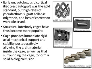 Spinal biomechanics and Fusion basics.pptx