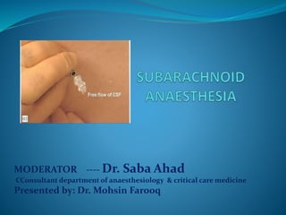 MODERATOR ---- Dr. Saba Ahad
CConsultant department of anaesthesiology & critical care medicine
Presented by: Dr. Mohsin Farooq
 