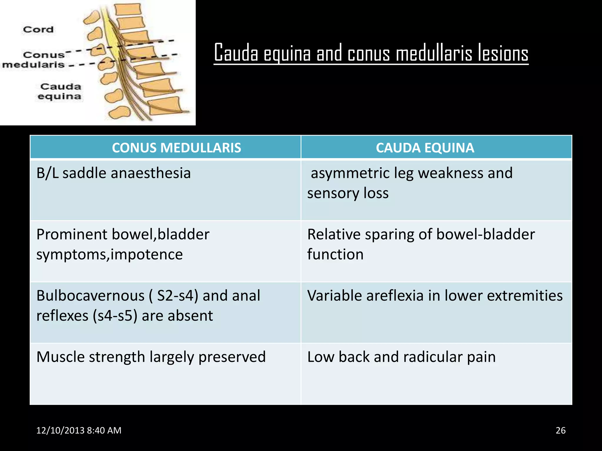 Cauda equina and conus medullaris lesions

CONUS MEDULLARIS

CAUDA EQUINA

B/L saddle anaesthesia

asymmetric leg weakness and
sensory loss

Prominent bowel,bladder
symptoms,impotence

Relative sparing of bowel-bladder
function

Bulbocavernous ( S2-s4) and anal
reflexes (s4-s5) are absent

Variable areflexia in lower extremities

Muscle strength largely preserved

Low back and radicular pain

12/10/2013 8:40 AM

26

 
