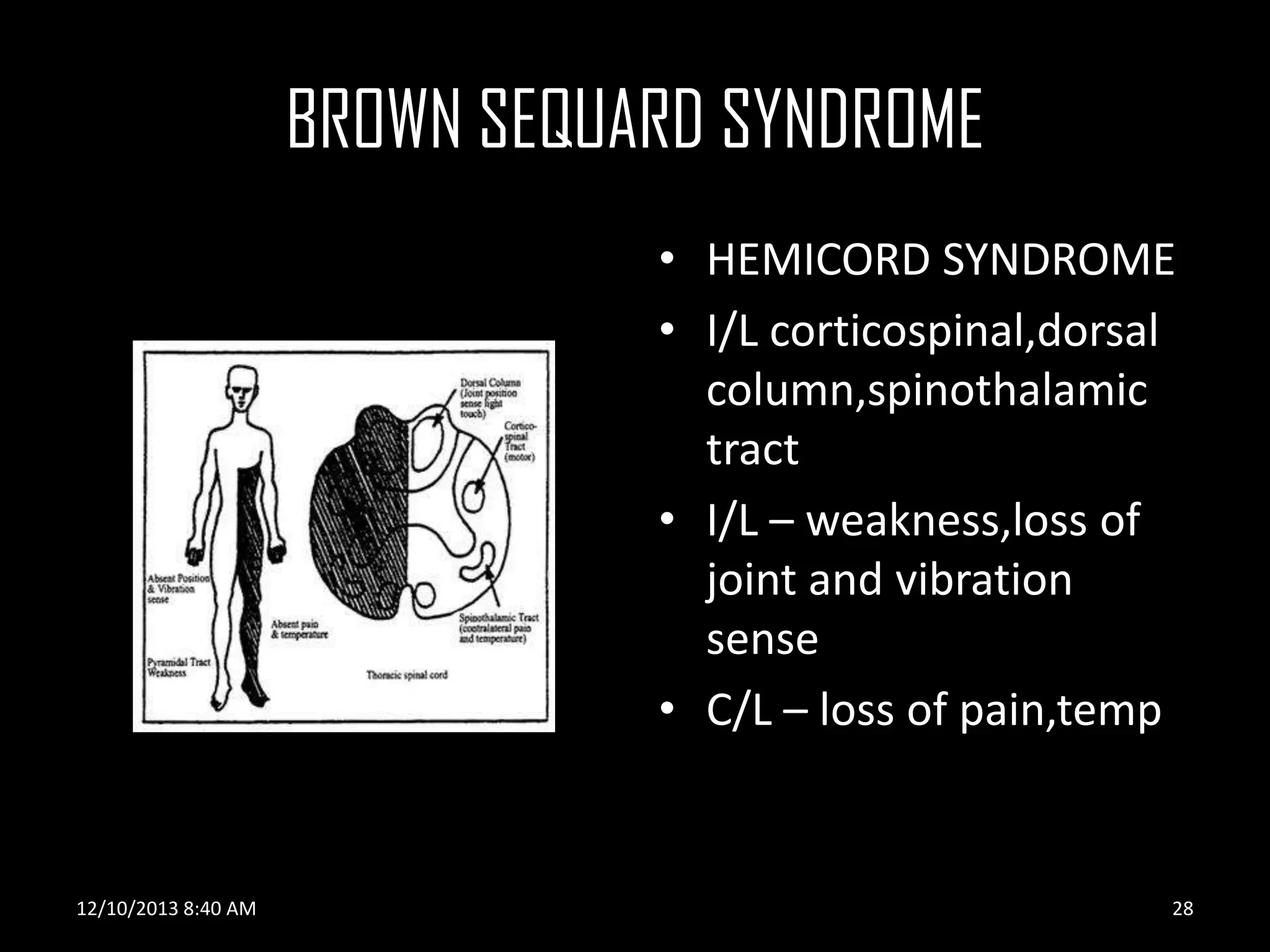 BROWN SEQUARD SYNDROME
• HEMICORD SYNDROME
• I/L corticospinal,dorsal
column,spinothalamic
tract
• I/L – weakness,loss of
joint and vibration
sense
• C/L – loss of pain,temp

12/10/2013 8:40 AM

28

 