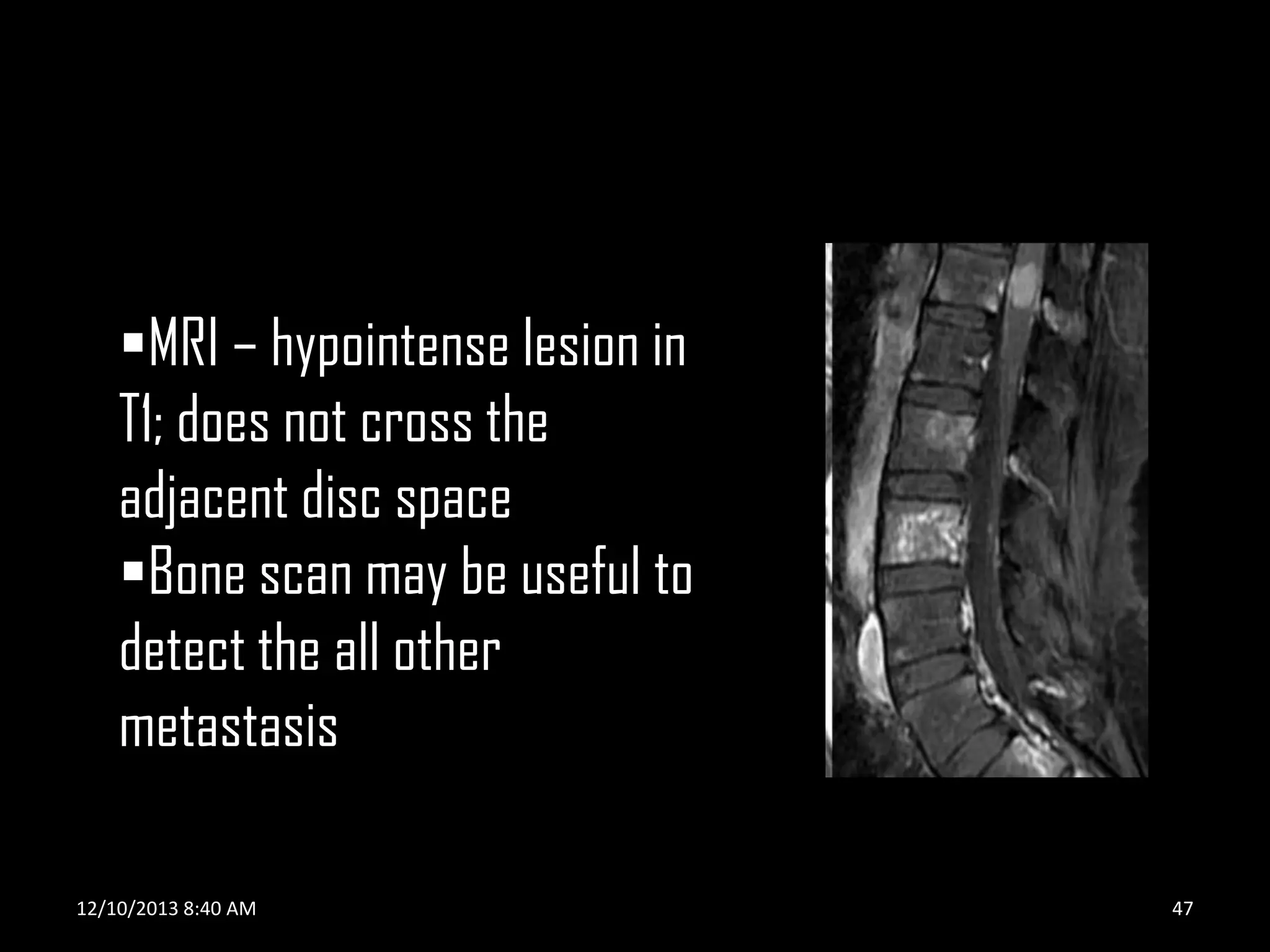 MRI – hypointense lesion in
T1; does not cross the
adjacent disc space
Bone scan may be useful to
detect the all other
metastasis
12/10/2013 8:40 AM

47

 