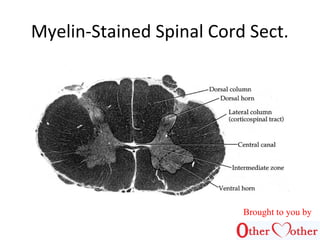 Myelin-Stained Spinal Cord Sect.
Brought to you by
 