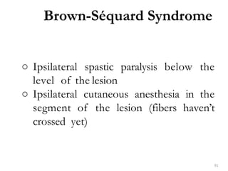 ○ Ipsilateral spastic paralysis below the
level of the lesion
○ Ipsilateral cutaneous anesthesia in the
segment of the lesion (fibers haven’t
crossed yet)
Brown-Séquard Syndrome
91
 