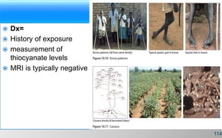  Dx=
 History of exposure
 measurement of
thiocyanate levels
 MRI is typically negative
114
 