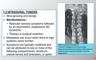 1.2 INTRADURAL TUMORS
 Slow-growing and benign.
 Manifestations:-
 Radicular sensory symptoms followed
by an asymmetric, progressive SC
syndrome.
 Therapy is surgical resection.
 Metastasis can occur when there is high
systemic tumor burden.
 Symptoms are typically multifocal and
can be attributed to one or more of the
following compartments: cerebrum,
cranial nerves and brainstem, or spine.
71
 