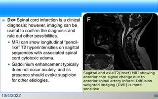  Dx= Spinal cord infarction is a clinical
diagnosis; however, imaging can be
useful to confirm the diagnosis and
rule out other possibilities.
 MRI can show longitudinal “pencil-
like” T2 hyperintensities on sagittal
sequences with associated spinal
cord cytotoxic edema.
 Gadolinium enhancement typically
does not occur acutely, and its
presence should evoke suspicion
for other etiologies.
10/4/2022 98
 