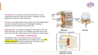 spinal cord disorders and paraplegia . | PPTX
