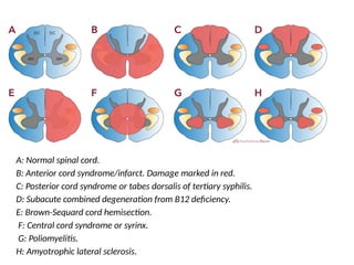 Cord Infarct Pattern Comprehensive Overview of Spinal Cord Syndromes and Injuries | PPT