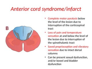 Cord Infarct Pattern Comprehensive Overview of Spinal Cord Syndromes and Injuries | PPT