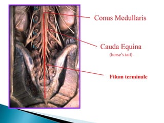 Conus Medullaris
Cauda Equina
(horse’s tail)
L5
L4
L3
L2
Filum terminale
 