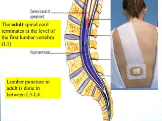 The adult spinal cord
terminates at the level of
the first lumbar vertebra
(L1)
Lumber puncture in
adult is done in
between L3-L4.
 