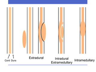 Diseases of Spinal Cord | PPT