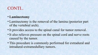 CONTI..
• Laminectomy
• Laminectomy is the removal of the lamina (posterior part
of the vertebral arch).
• It provides access to the spinal canal for tumor removal.
• It also relieves pressure on the spinal cord and nerve roots
caused by the tumor.
• This procedure is commonly performed for extradural and
intradural-extramedullary tumors.
 