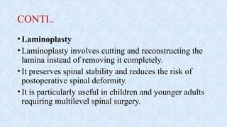 CONTI..
•Laminoplasty
•Laminoplasty involves cutting and reconstructing the
lamina instead of removing it completely.
•It preserves spinal stability and reduces the risk of
postoperative spinal deformity.
•It is particularly useful in children and younger adults
requiring multilevel spinal surgery.
 