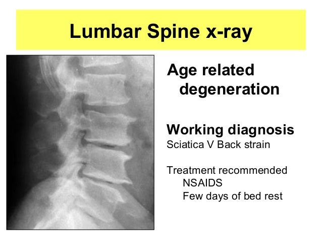 paracetamol definition day aos 2014 Spinal mar compression cord bhf final study