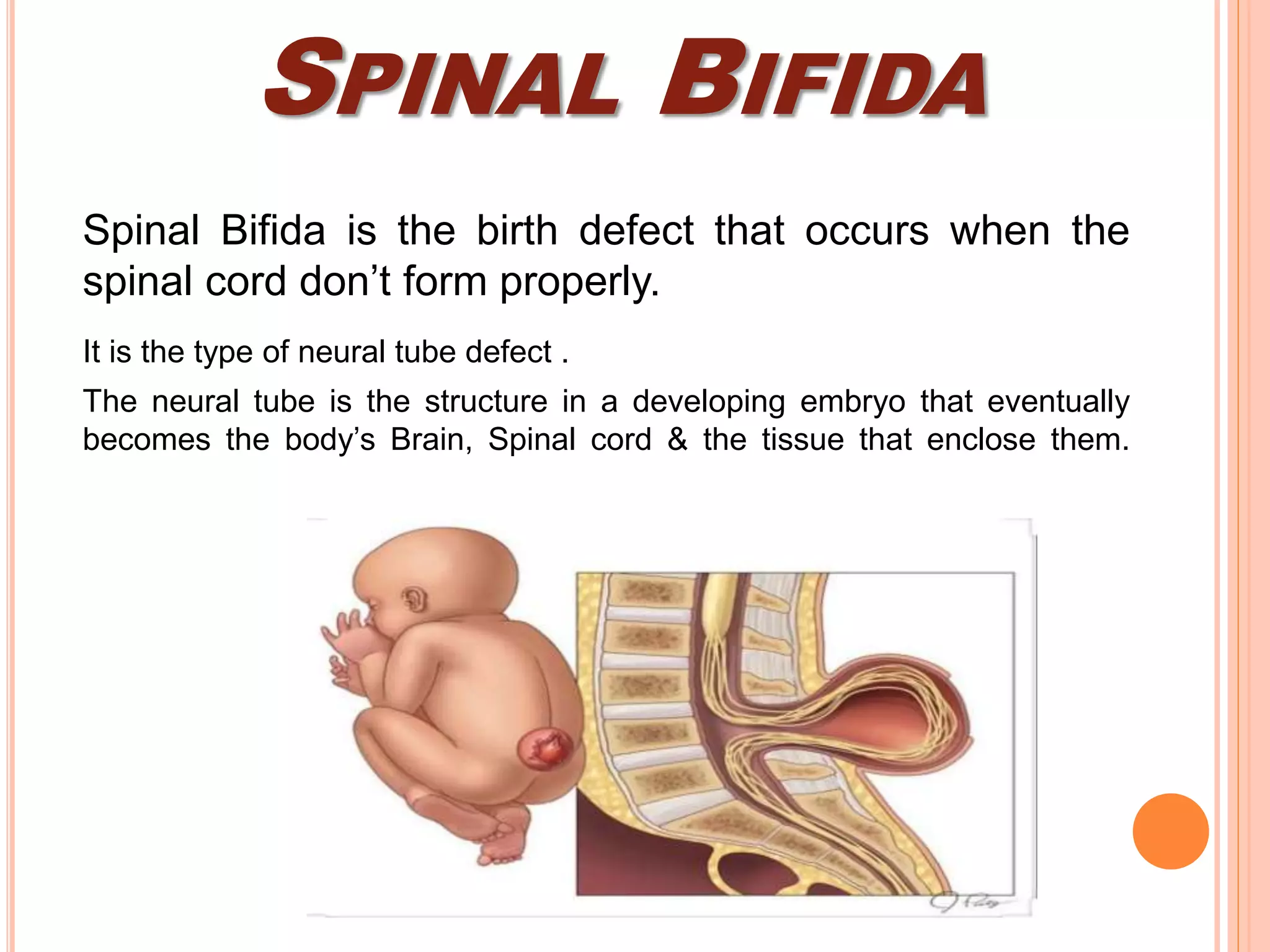 Spinal Defet Spinal cord disorders | PPTX