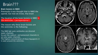 Brain???
Brain lesions in NMO
Previously it was thought that in NMO the
spared, but now we know, that brain
The location of the brain lesions in NMO is
the ventricles. ( periependymal )
The reason why these brain lesions are
the ventricles is the following:
The NMO IgG auto-antibodies are directed
water-channels.
So just like sodium- and potassium channels in
are also water-channels.
The highest concentration of these Aquaporin-4
is seen around the ventricles.
 