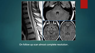 On follow up scan almost complete resolution .
 