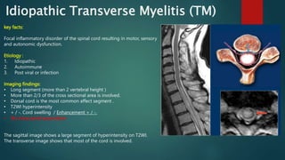 Idiopathic Transverse Myelitis (TM)
key facts:
Focal inflammatory disorder of the spinal cord resulting in motor, sensory
and autonomic dysfunction.
Etiology :
1. Idiopathic
2. Autoimmune
3. Post viral or infection
Imaging findings:
• Long segment (more than 2 vertebral height )
• More than 2/3 of the cross sectional area is involved.
• Dorsal cord is the most common affect segment .
• T2WI hyperintensity
• + / -. Cord swelling / Enhancement + / -.
• No intracranial association
The sagittal image shows a large segment of hyperintensity on T2WI.
The transverse image shows that most of the cord is involved.
 