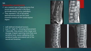 NB :
Myxopapillary ependymomas
 are a variant type of ependymoma that
occurs predominantly in the filum
terminale and/or conus medullaris.
 They represent 13% of all spinal
ependymomas and are the most
common tumors of the cauda equina
region.
• well-defined intradural tumors.
• Low T1 , high T2 , showing enhancement
• Classically, they present when larger and
sausage-shaped, spanning more than one
vertebral level, cause scalloping of the
vertebral bodies and extend out of the
neural exit foramina.
 