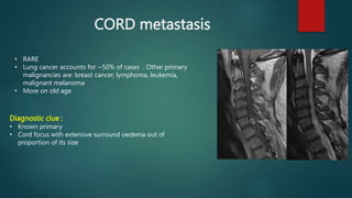 CORD metastasis
• RARE
• Lung cancer accounts for ~50% of cases . Other primary
malignancies are: breast cancer, lymphoma, leukemia,
malignant melanoma
• More on old age
Diagnostic clue :
• Known primary
• Cord focus with extensive surround oedema out of
proportion of its size
 