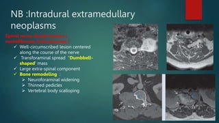 NB :Intradural extramedullary
neoplasms
Spinal nerve sheath tumors (
neurofibroma /schwannoma )
 Well-circumscribed lesion centered
along the course of the nerve
 Transforaminal spread “Dumbbell-
shaped' mass
 Large extra-spinal component
 Bone remodeling :
 Neuroforaminal widening
 Thinned pedicles
 Vertebral body scalloping
 