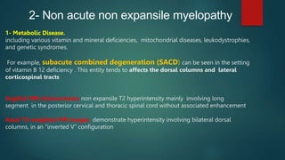 2- Non acute non expansile myelopathy
1- Metabolic Disease.
including various vitamin and mineral deficiencies, mitochondrial diseases, leukodystrophies,
and genetic syndromes.
For example, subacute combined degeneration (SACD) can be seen in the setting
of vitamin B 12 deficiency . This entity tends to affects the dorsal columns and lateral
corticospinal tracts
Sagittal MRI demonstrates non expansile T2 hyperintensity mainly involving long
segment in the posterior cervical and thoracic spinal cord without associated enhancement
Axial T2-weighted MR images demonstrate hyperintensity involving bilateral dorsal
columns, in an “inverted V” configuration
 