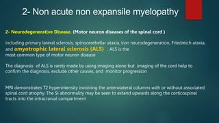 2- Non acute non expansile myelopathy
2- Neurodegenerative Disease. (Motor neuron diseases of the spinal cord )
including primary lateral sclerosis, spinocerebellar ataxia, iron neurodegeneration, Friedreich ataxia,
and amyotrophic lateral sclerosis (ALS) . ALS is the
most common type of motor neuron disease
The diagnosis of ALS is rarely made by using imaging alone but imaging of the cord help to
confirm the diagnosis, exclude other causes, and monitor progression
MRI demonstrates T2 hyperintensity involving the anterolateral columns with or without associated
spinal cord atrophy. The SI abnormality may be seen to extend upwards along the corticospinal
tracts into the intracranial compartment
 