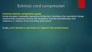 Common extrinsic compressive causes
Include discogenic myelopathy, ligamentous thickening or redundancy from spondylotic change,
vertebral body compression fracture with retropulsion, traumatic facet dislocation, and
malignancy or infection of the surrounding spinal column
Usually, cord SI alteration is seen focally at or adjacent to the causative feature
 