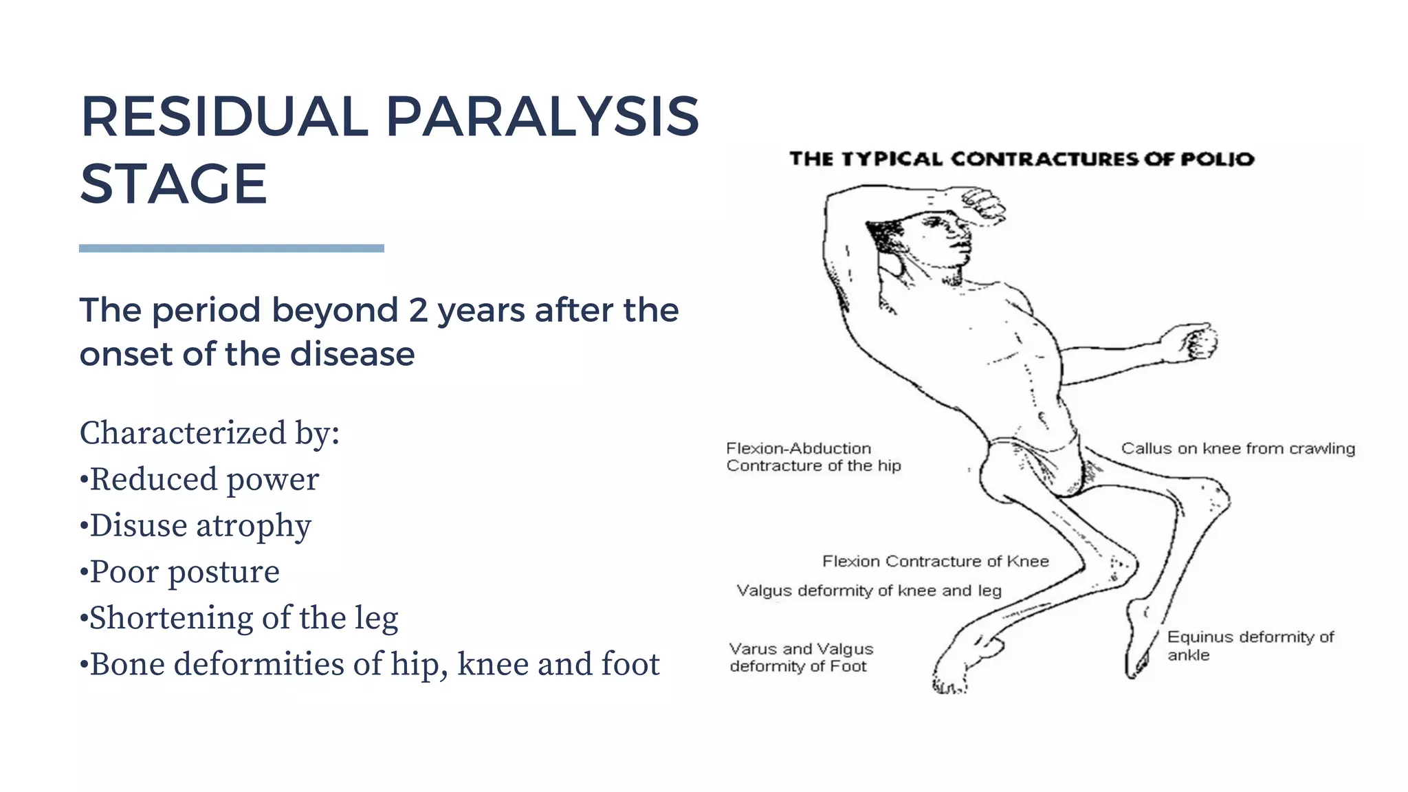 Spinal Cord Disease - Clinical Presentations and Management | PDF