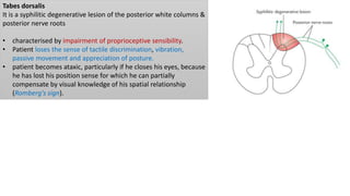 Tabes dorsalis
It is a syphilitic degenerative lesion of the posterior white columns &
posterior nerve roots
• characterised by impairment of proprioceptive sensibility.
• Patient loses the sense of tactile discrimination, vibration,
passive movement and appreciation of posture.
• patient becomes ataxic, particularly if he closes his eyes, because
he has lost his position sense for which he can partially
compensate by visual knowledge of his spatial relationship
(Romberg's sign).
 