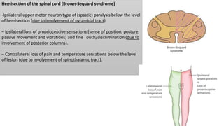 Hemisection of the spinal cord (Brown-Sequard syndrome)
-Ipsilateral upper motor neuron type of (spastic) paralysis below the level
of hemisection (due to involvement of pyramidal tract).
– Ipsilateral loss of proprioceptive sensations (sense of position, posture,
passive movement and vibrations) and fine ouch/discrimination (due to
involvement of posterior columns).
– Contralateral loss of pain and temperature sensations below the level
of lesion (due to involvement of spinothalamic tract).
 