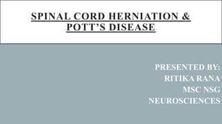 SPINAL CORD HERNIATION &
POTT’S DISEASE
PRESENTED BY:
RITIKA RANA
MSC NSG
NEUROSCIENCES
 