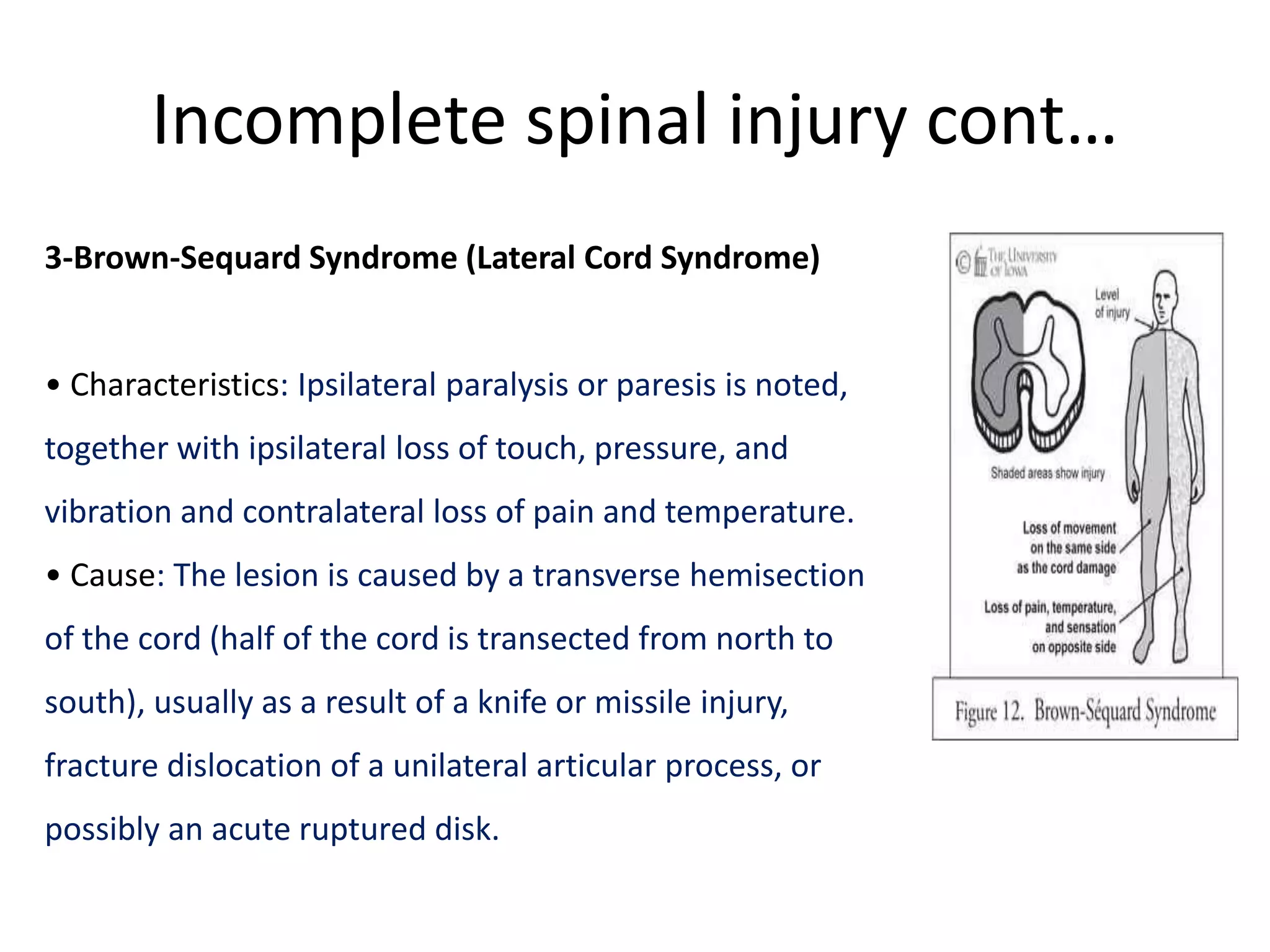 Spinal cord injuries | PPTX
