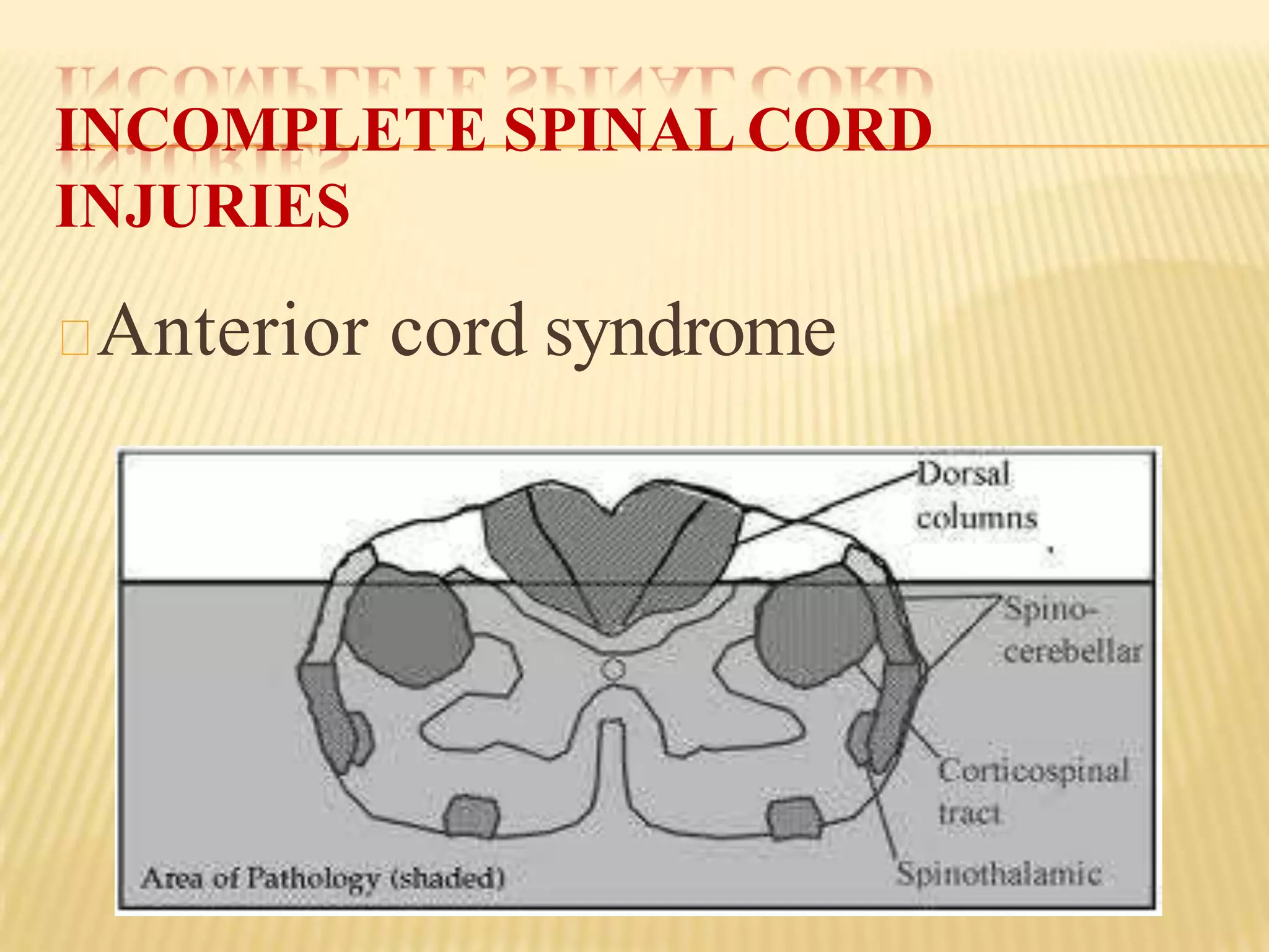 Spinal Cord Injuries.pptx