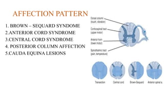 AFFECTION PATTERN
1. BROWN – SEQUARD SYNDOME
2.ANTERIOR CORD SYNDROME
3.CENTRAL CORD SYNDROME
4. POSTERIOR COLUMN AFFECTION
5.CAUDA EQUINA LESIONS
 
