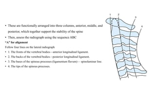 • These are functionally arranged into three columns, anterior, middle, and
posterior, which together support the stability of the spine
• Then, assess the radiograph using the sequence ABC
“A” for alignment
Follow four lines on the lateral radiograph
• 1. The fronts of the vertebral bodies—anterior longitudinal ligament.
• 2. The backs of the vertebral bodies—posterior longitudinal ligament.
• 3. The bases of the spinous processes (ligamentum flavum)— spinolaminar line.
• 4. The tips of the spinous processes.
 