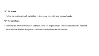 “B” for bones
• Follow the outline of each individual vertebra, and check for any steps or breaks.
“C” for cartilages
• Examine the intervertebral discs and facet joints for displacement. The disc space may be widened
if the annulus fibrosus is ruptured or narrowed in degenerative disc disease.
 