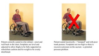 Patient correctly seated in whe elchair—erect and
well back in the chair; footplates are level and
adjusted to allow thighs to be fully supported on
wheelchair cushion and for weight to be evenly
distributed.
Patient seated incorrectly—“slumped” and with poor
trunk posture. Footplates are too high so there is
excessive pressure on the sacrum—a potential
pressure problem
 